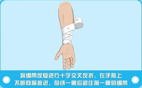 这些急救知识,每个人都应该了解