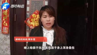 怀孕教师竟将11岁女童打致浑身淤紫我这是产前焦虑