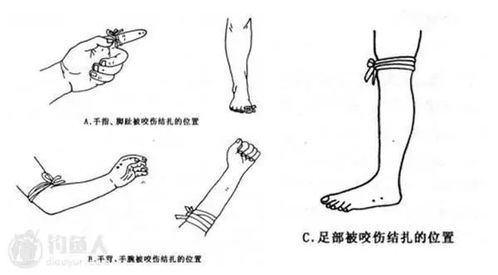 近心端和远心端包扎