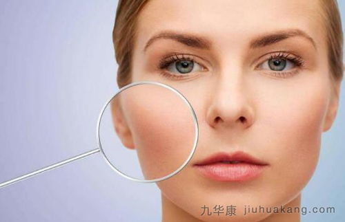 四个症状说明你的皮肤缺水了
