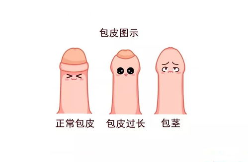 无数宝宝白挨一刀,其实这种病根本不用治