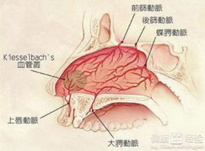 鼻咽癌会诱发什么疾病