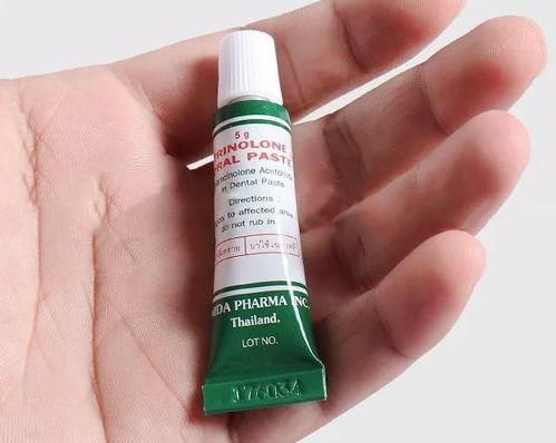 口腔溃疡再也不怕痛泰国爆好用小药膏,10秒止痛,3次痊愈