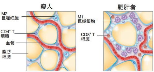 你以为运动节食会瘦身错,那只是让你的脂肪缩水了