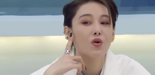 张馨予跳舞受伤,膝盖肿成调色板针灸视频曝光,何捷看后心疼