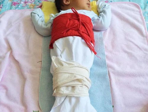 06岁宝宝的腿不是越直越好,妈妈千万别害了孩子