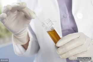 肝脏比较健康的人不会出现这5个问题