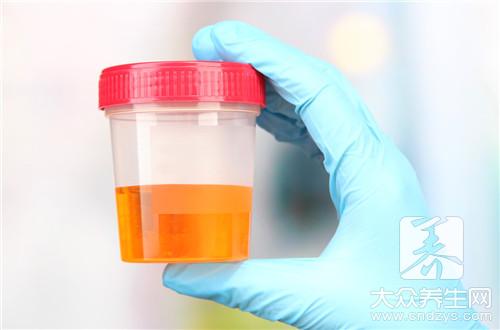肝不好的人,早上起床会有这4个症状,希望你一个也没有