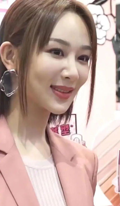 杨紫面部肿胀似发面馒头,脸部僵硬没有表情,疑似整容失败