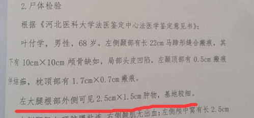 交通事故司法鉴定意见书三次鉴定不同,对案件有何影响法院会如何采用