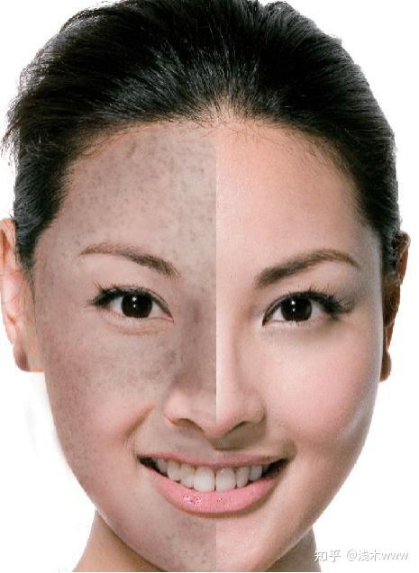 皮肤容易吃妆怎么办