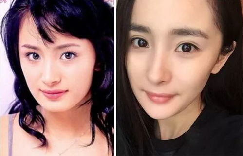 表情拔智齿可以瘦脸吗表情