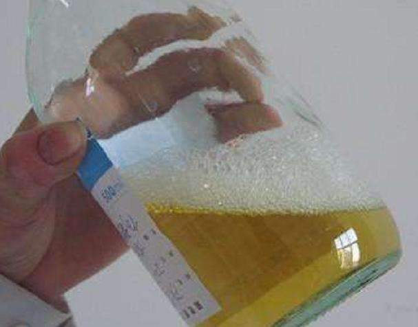 自测尿酸水平如果你的尿是这样的,就要小心了