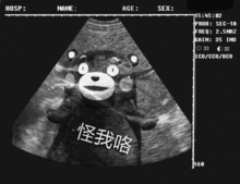 印度的游客说,用手抓才是最正确的吃饭方式,我带他去吃了火锅清水