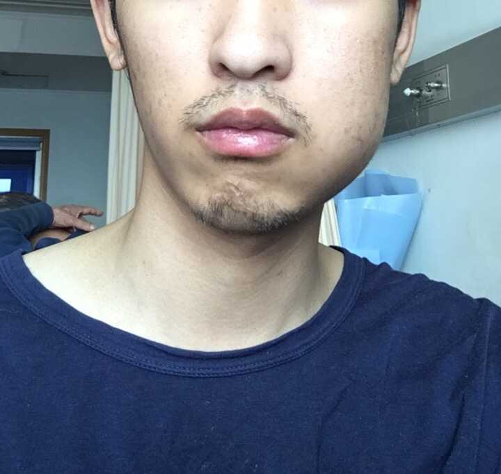 表情拔智齿有多痛表情