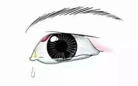 长了针眼怎么办千万不能这样做,严重可致失明