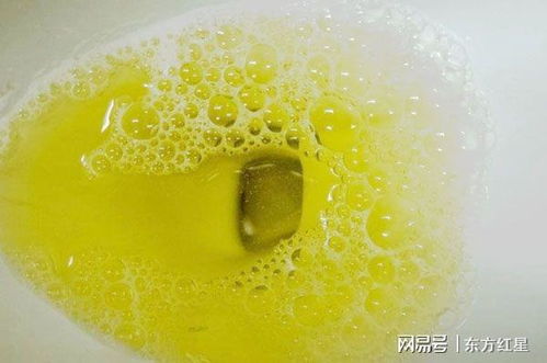 年轻男子没有任何症状查出尿毒症,如何早期发现并治疗慢性肾炎