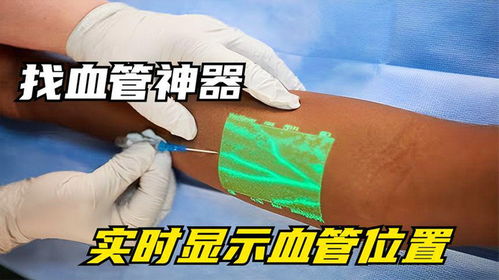 黑科技血管透视仪,能照遍身体上的血管,让护士打针百发百中