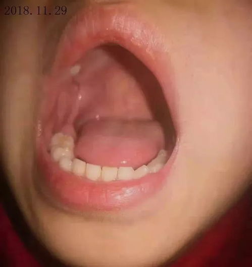 口腔问题别着急,佑三软膏来帮您
