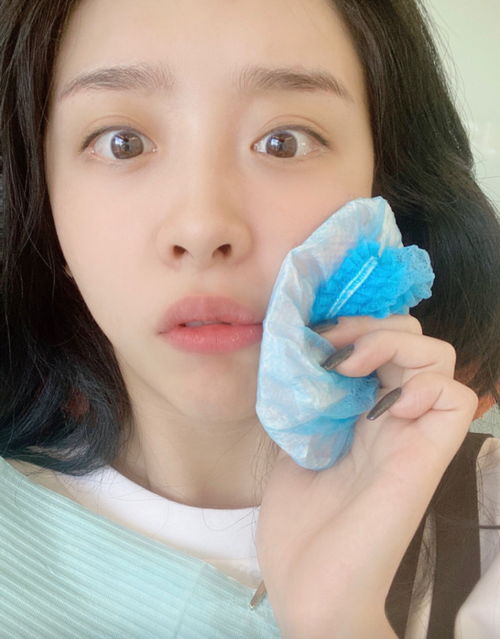 赵小棠发文真疼,拔牙后秒变表情包,搞笑程度不输虞书欣