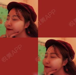 女生三大乐趣吃饭逛街和美容,我感觉自己身体力行的...丰面颊悦美整形