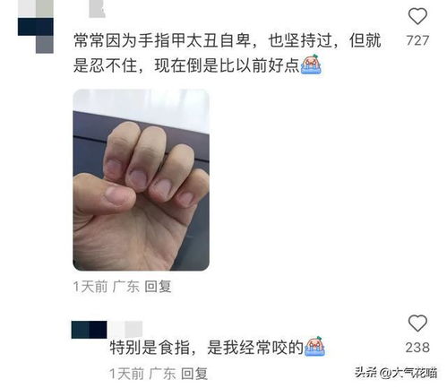 原来这么多人有吃手啃指甲的习惯网友这次必须戒成功