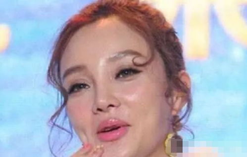 被玻尿酸毁掉的明星,周迅上榜,娄艺潇变窝瓜脸