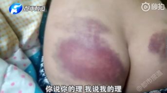 周口怀孕教师将11岁女童打到淤紫,校方其有产前焦虑,已辞退