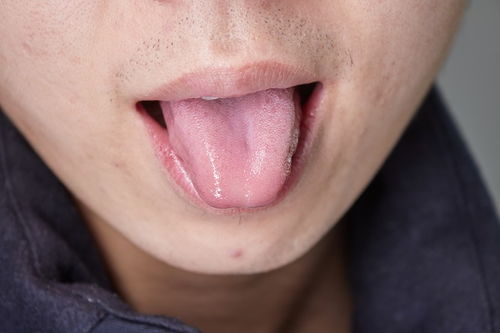 夜里睡觉身上总是发麻,会是脑梗的信号吗要留意2个部位的发麻