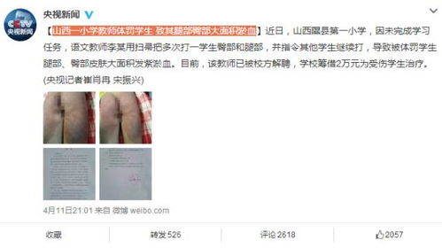 山西一小学教师体罚学生致其腿部臀部大面积淤血