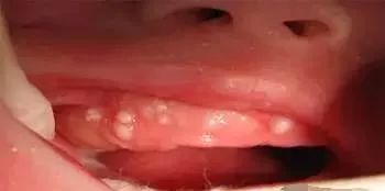 关于给宝宝口腔护理的常识,有这一篇就够了