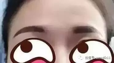 刚做的眉毛不对称别急看这里