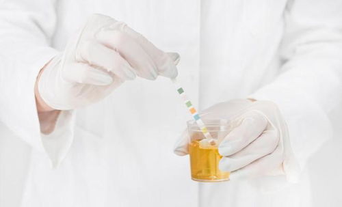 尿液像水一样清澈,才代表正常医生提醒这6种颜色要小心