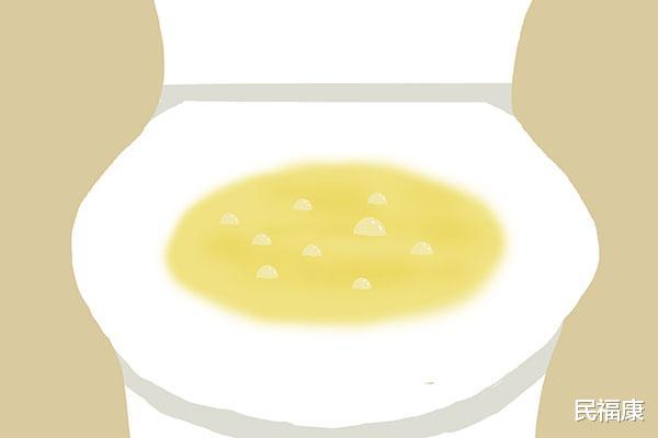 血糖是否超标,对照尿液异常检查下,若没有2个怪象,该高兴